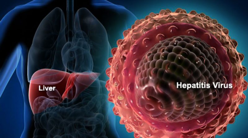 Hepatitis C, Gampang Menular Tapi Bisa Disembuhkan
